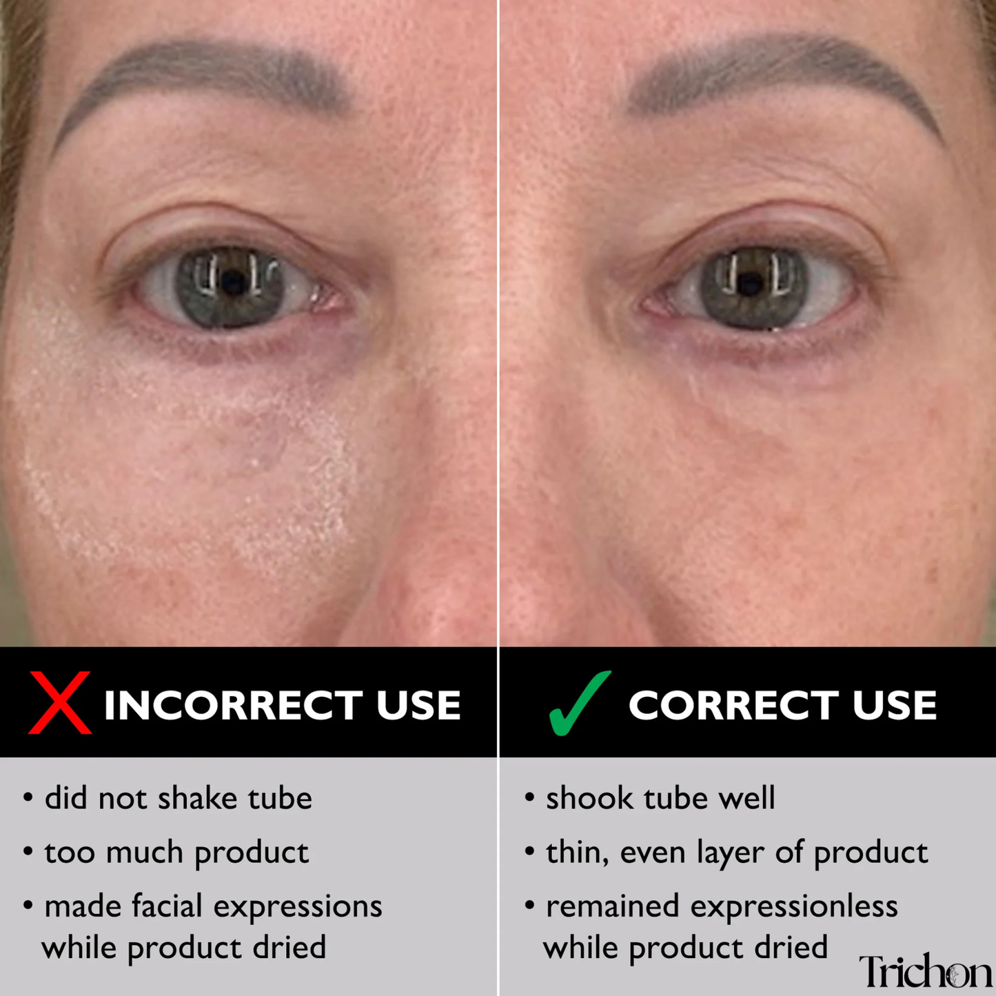 TrichonLabs LiftIQ™ Face Lift Serum