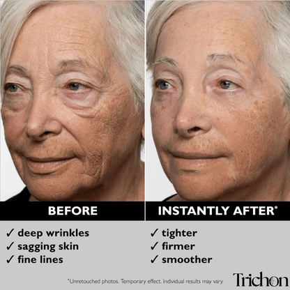 LiftIQ™ Add-On 2-Pack - Trichon Labs